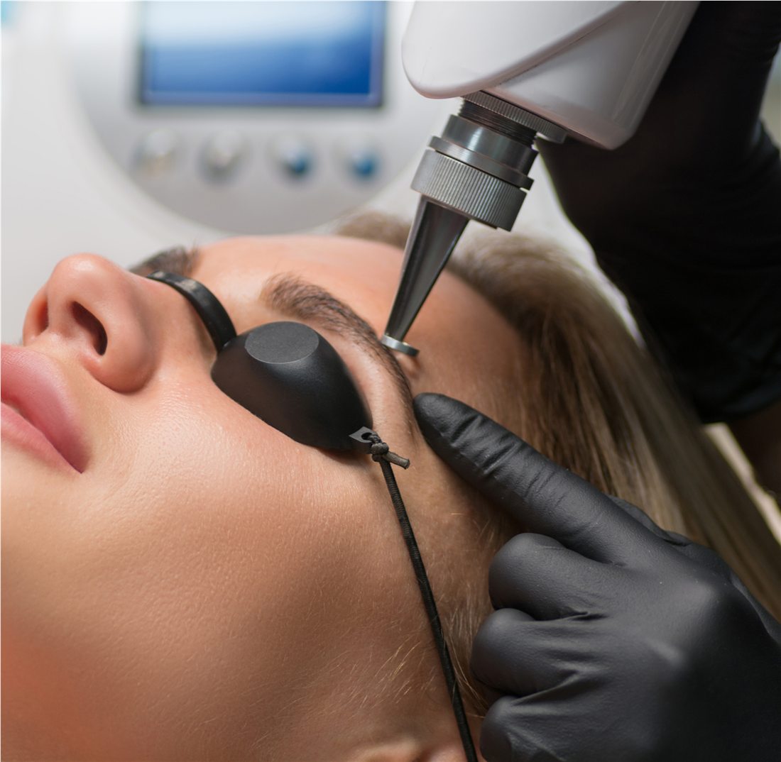 Eyebrow permanent makeup removal result
